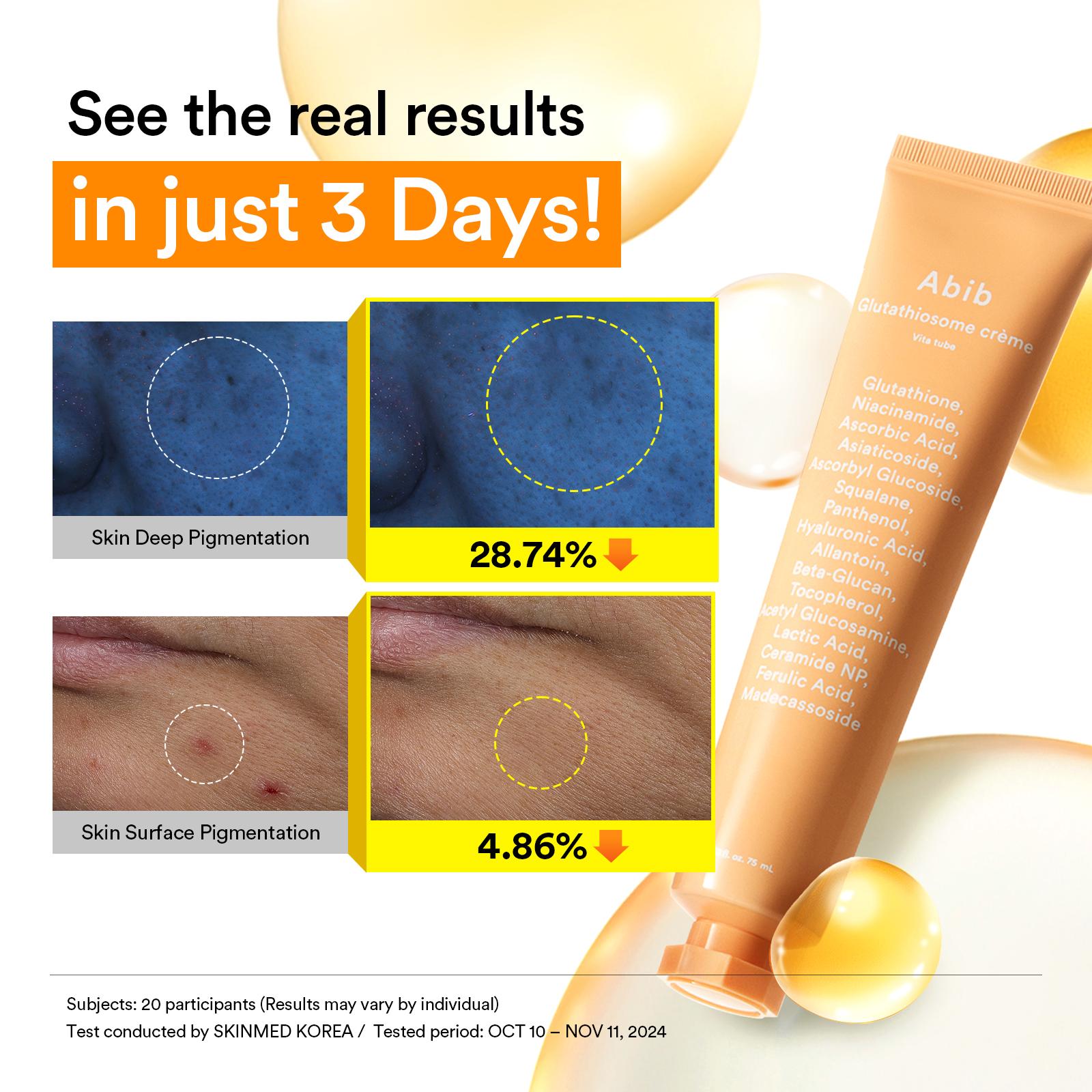 Abib Glutathiosome Dark Spot Cream Vita Tube 75ml | OLIVE YOUNG Global