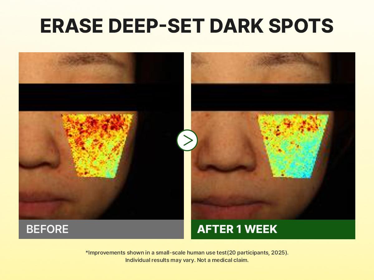 goodal Green Tangerine Vita-C Dark Spot Care Cream α 75ml Refill Set