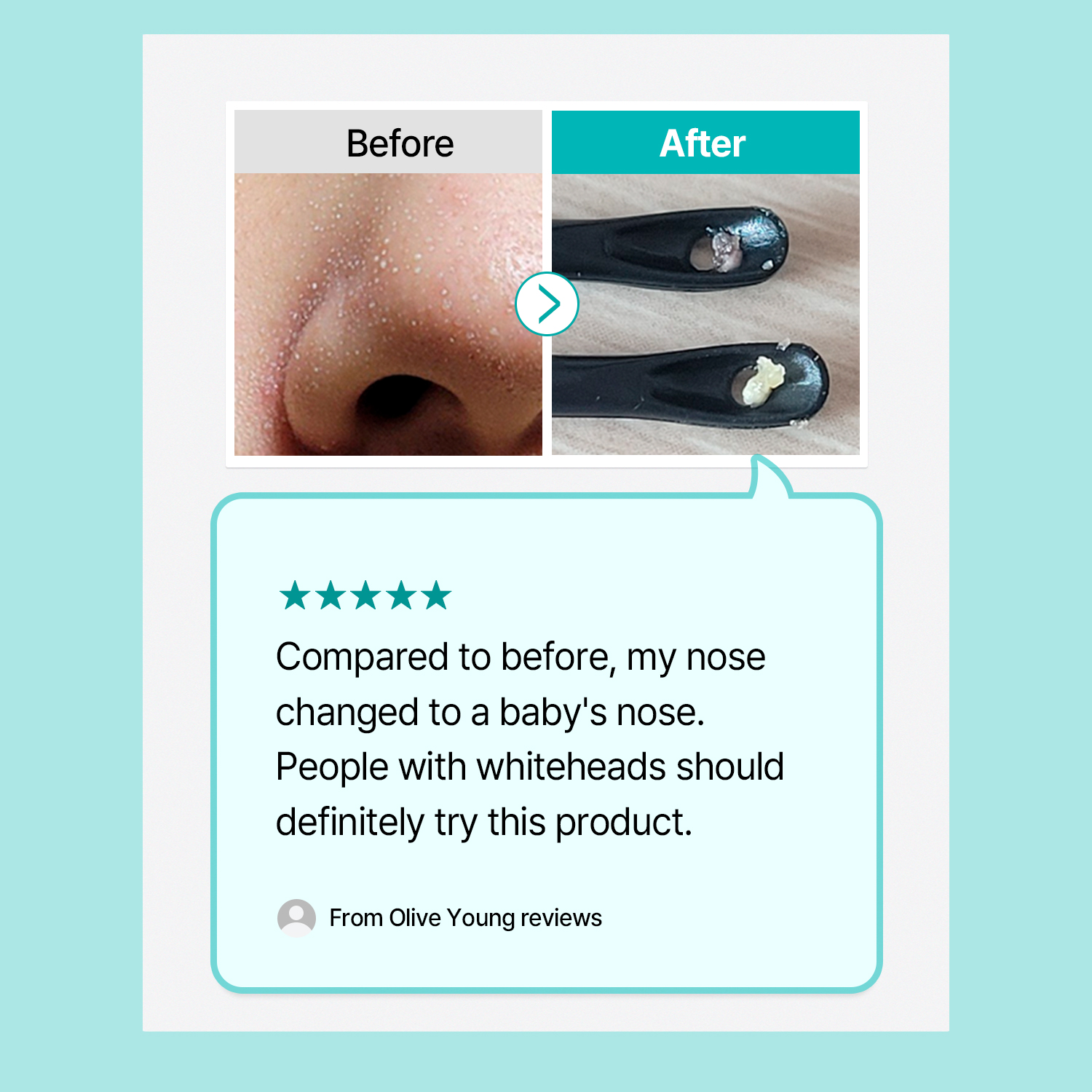 ilso Natural Mild Clear Nose Patch 5ea | OLIVE YOUNG Global