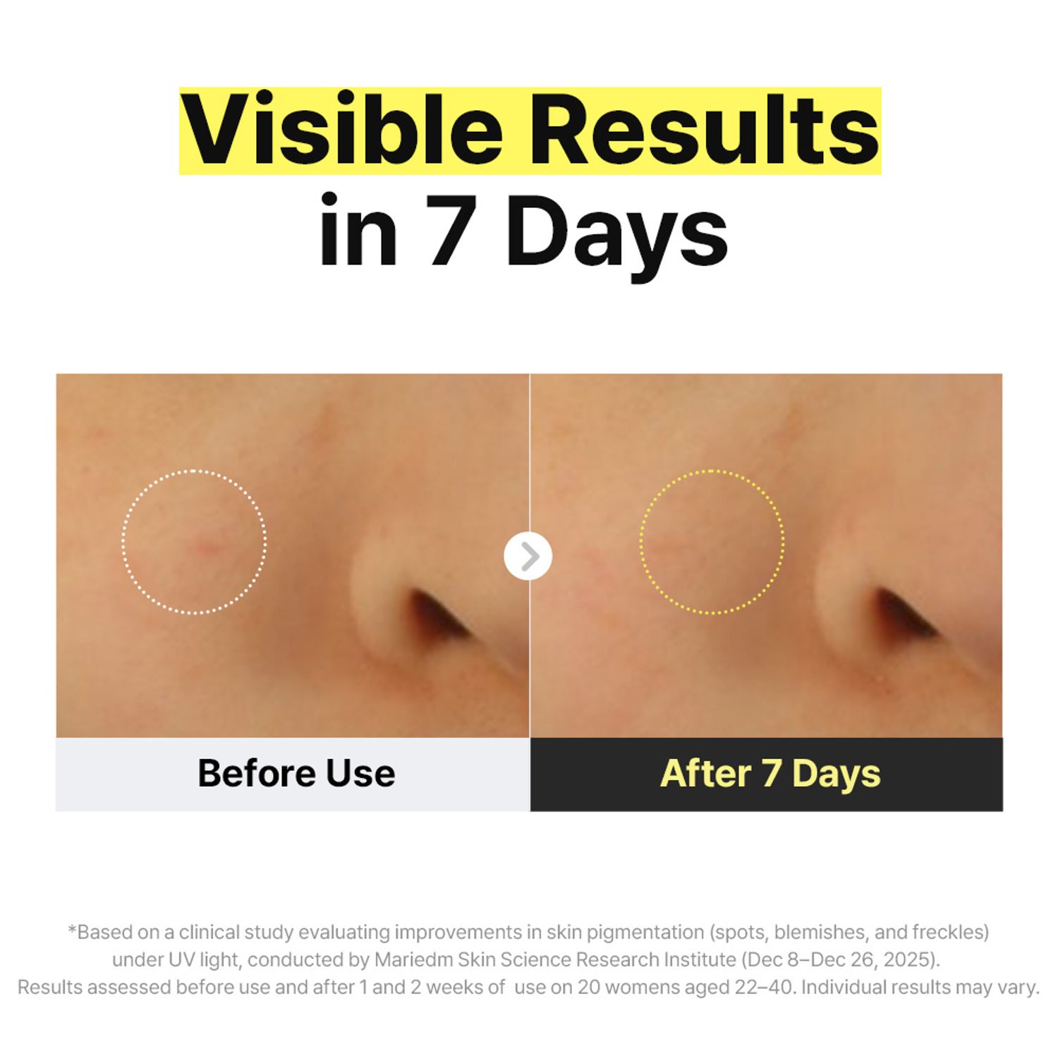 glutathione eye color change manyo Glutathione 7 Dark Spot Serum 30ml