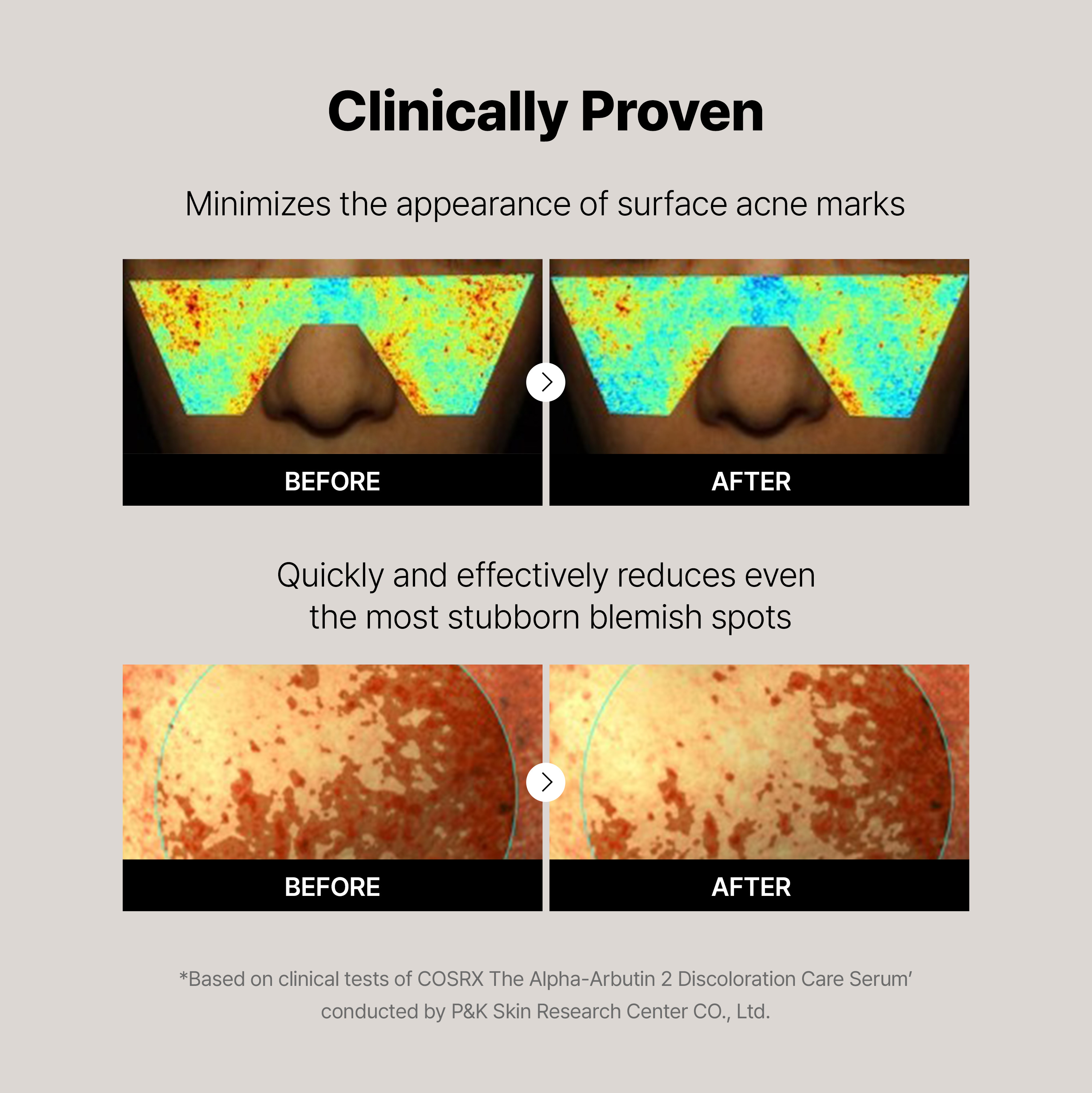 OUT OF STOCK COSRX 6ペプチド＆アルファアルブチン セラムセッ 【楽天