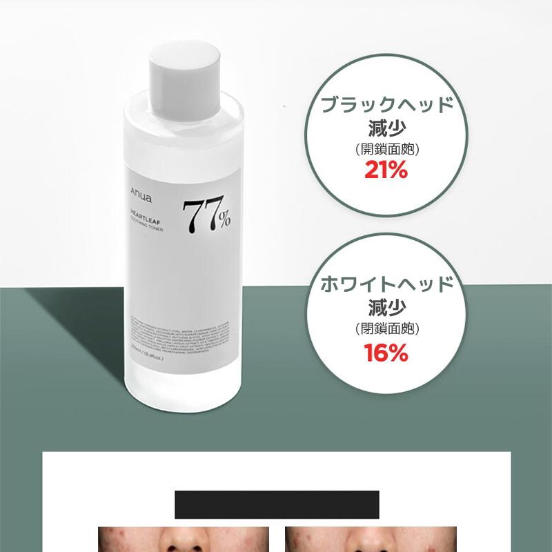 Anua ドクダミ77スージングトナー 250ml (+ローション100ml) | OLIVE