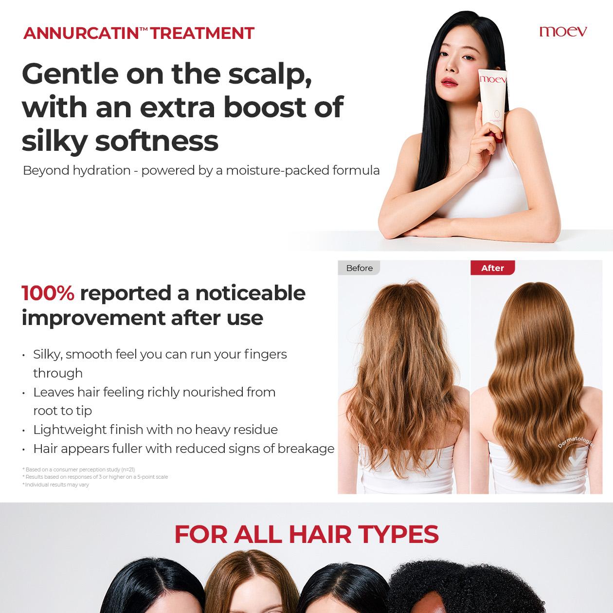 moev Anukatin Treatment 200ml (RENEWAL) | OLIVE YOUNG Global