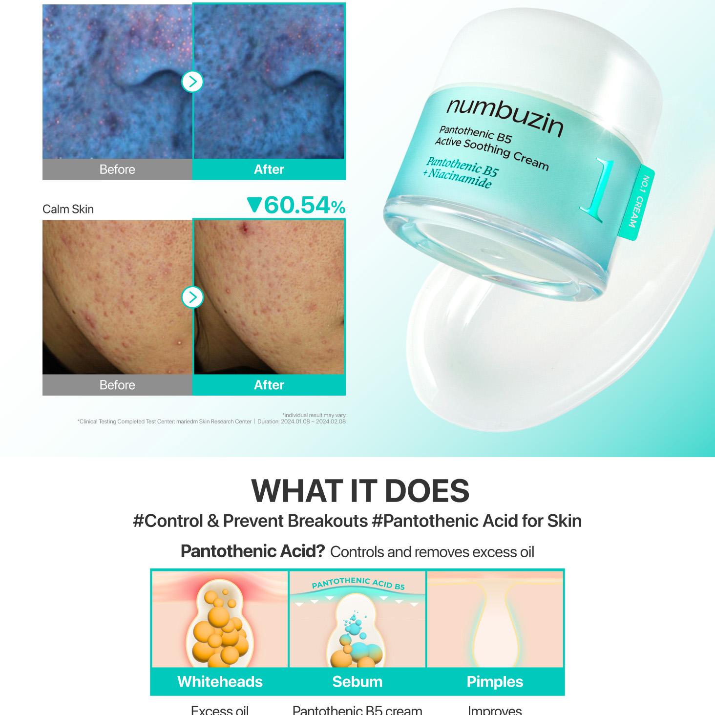 numbuzin No. 1 Pantothenic B5 Active Soothing Cream 80ml Double