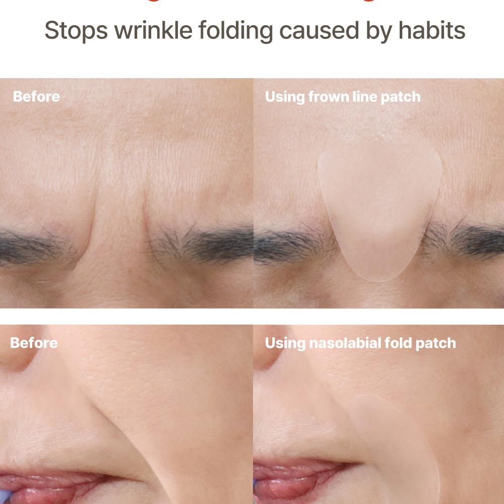 MARSHIQUE リンクルリペアパッチ (ほうれい線) 36枚 | OLIVE YOUNG Global