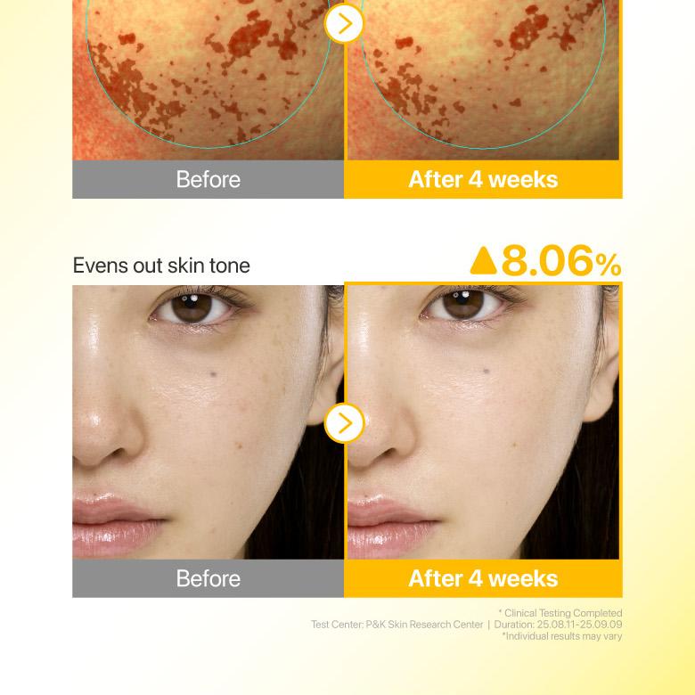 numbuzin - no.5 glutathione txa advanced dark spot ampoule concentrate numbuzin No.5 Glutathione TXA Advanced Dark Spot Ampoule Concentrate
