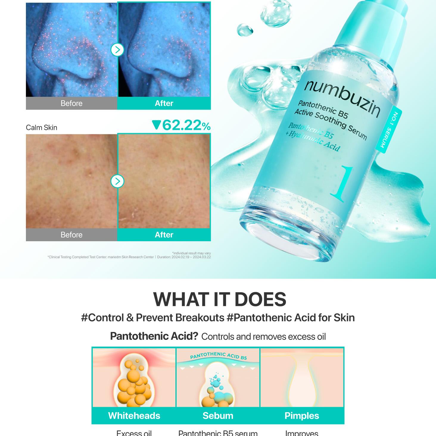 numbuzin No. 1 Pantothenic B5 Active Soothing Serum 80ml Set (+