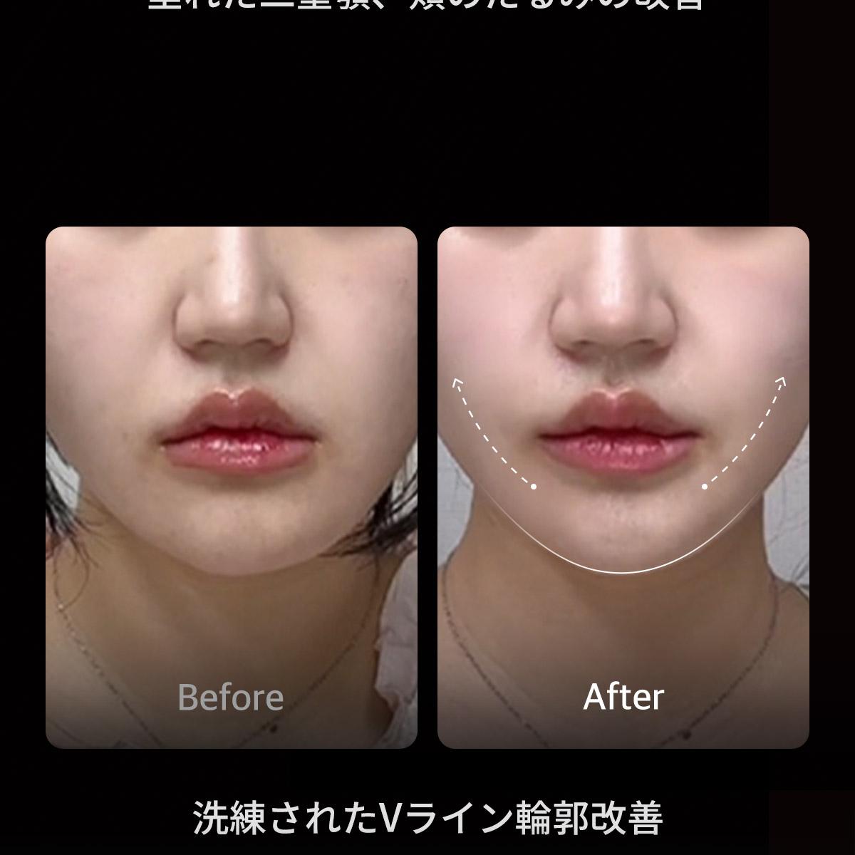 MEDICUBE AGE-R ハイフォーカスショット | OLIVE YOUNG Global